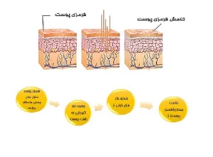 قیمت استند نور درمانی