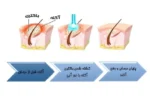 قیمت استند نور درمانی