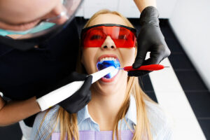 Dental restorations