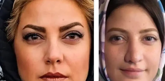 جراحی زیبایی طناز طباطبایی