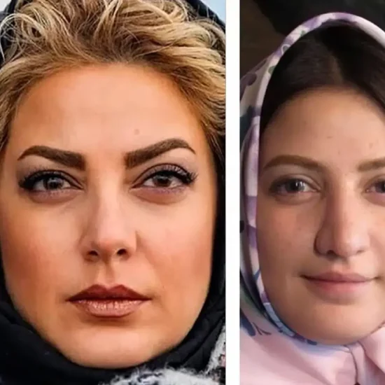 جراحی زیبایی طناز طباطبایی