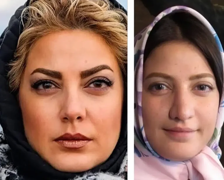 جراحی زیبایی طناز طباطبایی