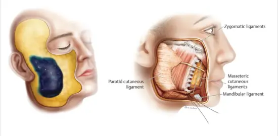 Zygomatic and buccal
