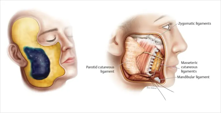 Zygomatic and buccal