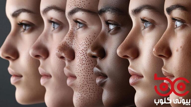 subcision-and-microneedling