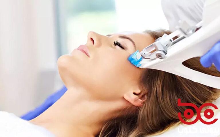 carboxytherapy