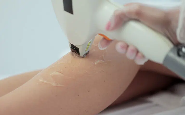 کدام دستگاه لیزر درد کمتری دارد؟