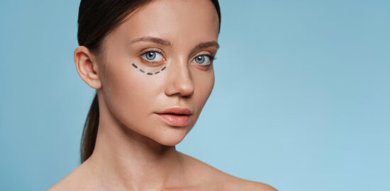 مزایا و معایب عمل بلفاروپلاستی