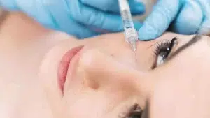 فیلر زیر چشم