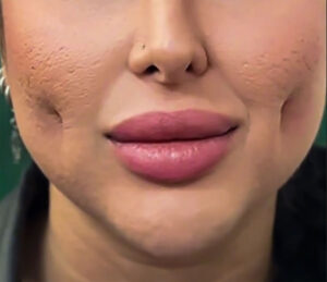 چال گونه غیر طبیعی