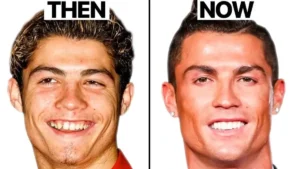 Cristiano Ronaldo plastic surgery