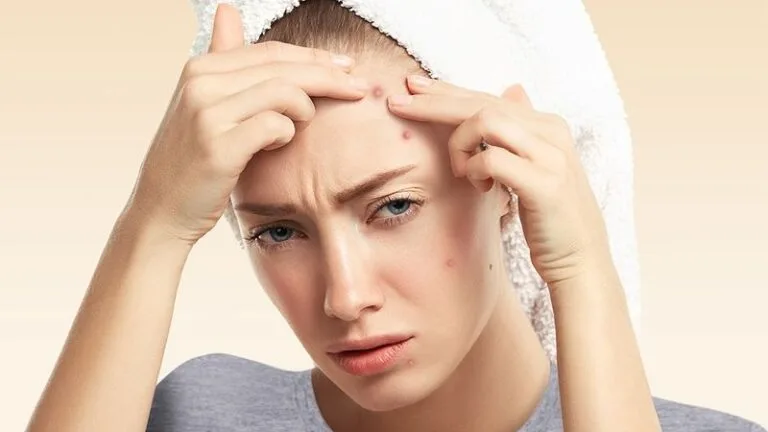 پیشگیری از جوش صورت