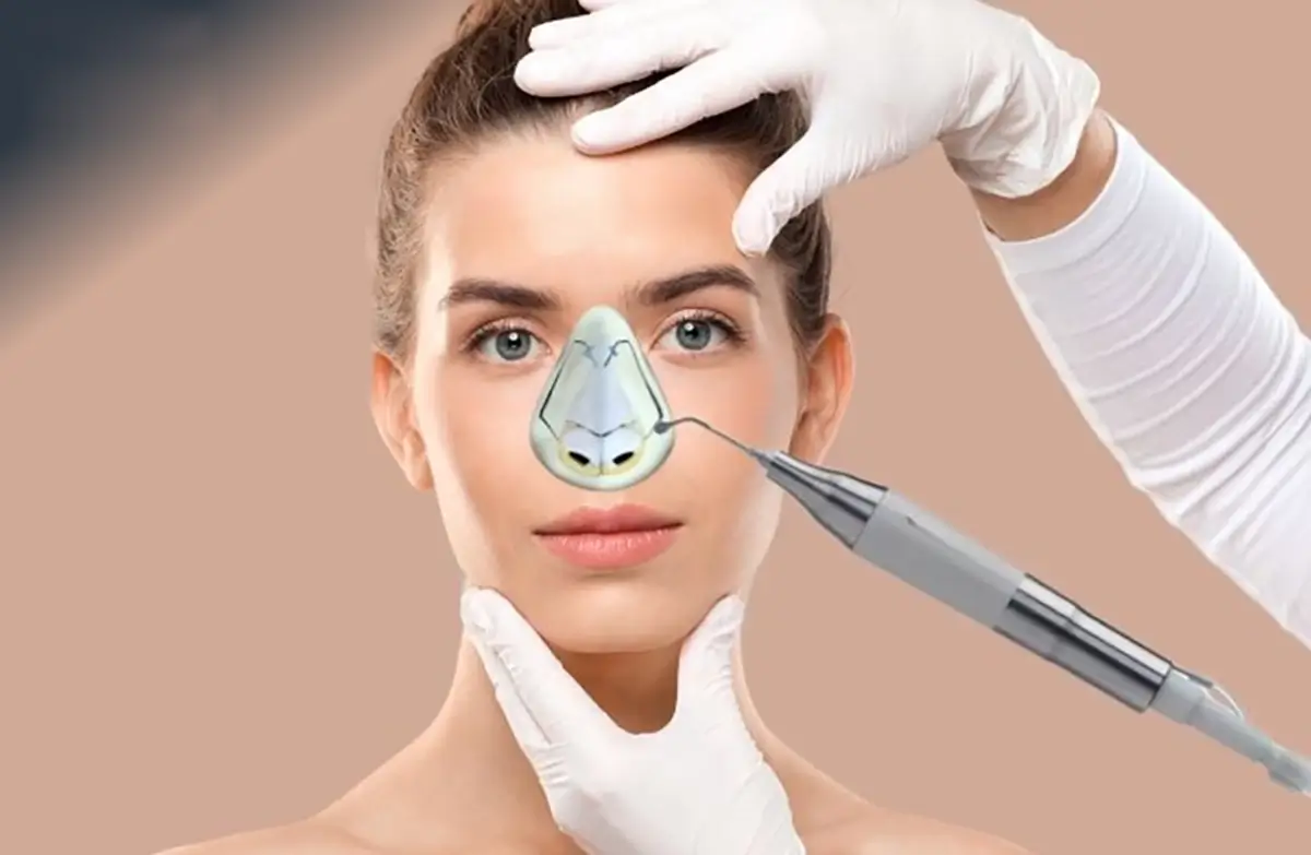 راهنمای خرید دستگاه جراحی بینی پیزو