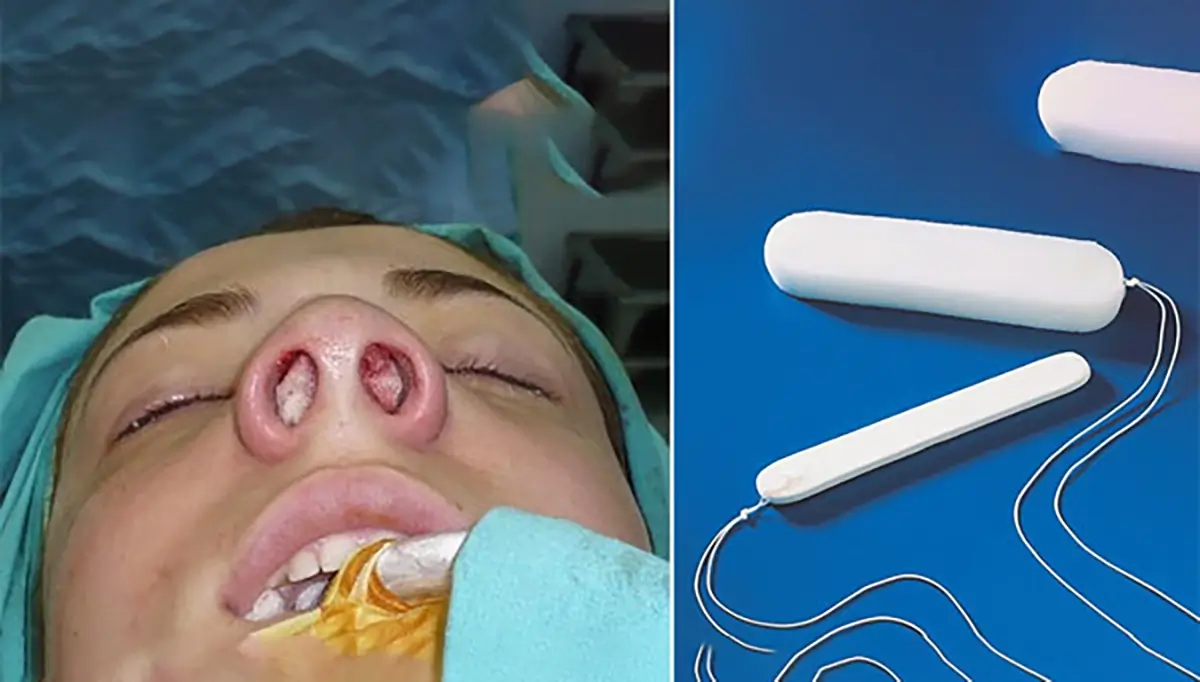 تامپون بعد از عمل بینی