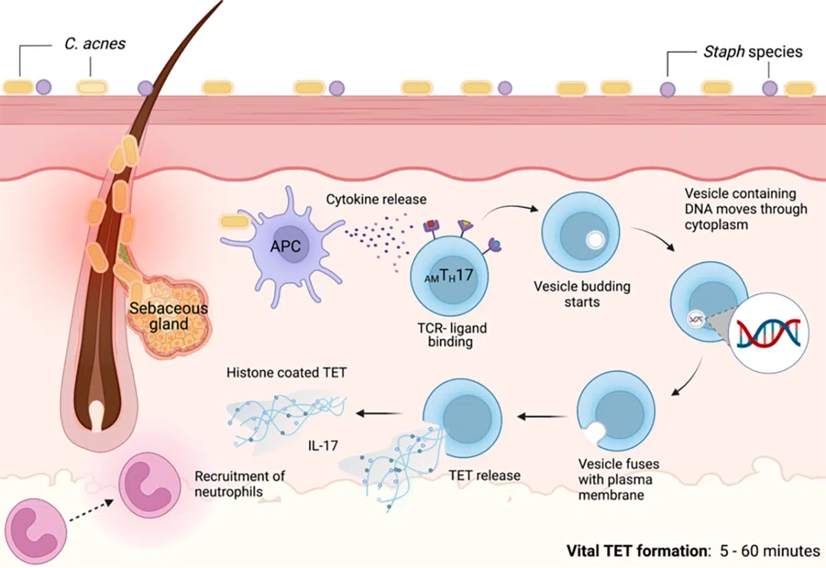 علل بروز جوش در نقاط مختلف بدن