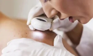لکه‌های سفید روی پوست کمبود کدام ویتامین