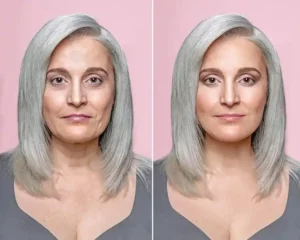 قیمت عکاسی تبلیغاتی کلینیک زیبایی