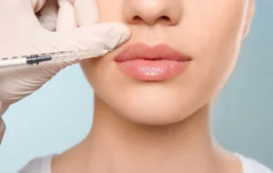 اردکی شدن لب بعد از تزریق فیلر | علل، پیشگیری و اصلاح