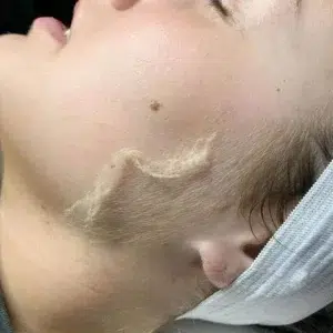 راهنمای طلایی لیزر موهای زائد