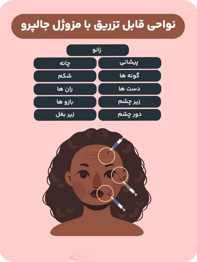 انواع جالپرو