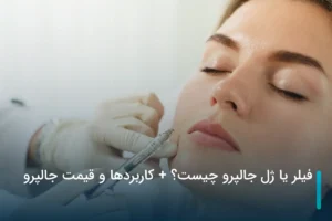 انواع جالپرو