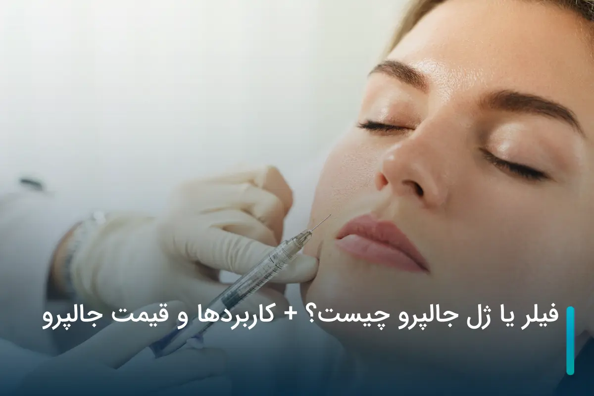 انواع جالپرو