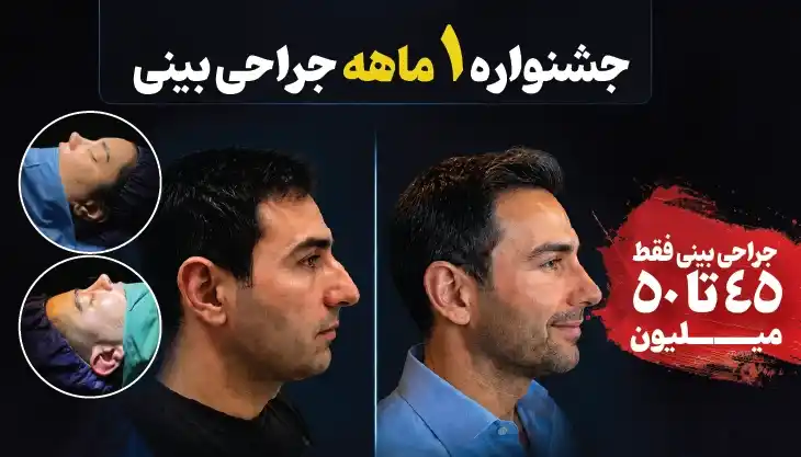 قیمت جراحی بینی