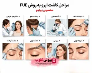 کاشت ابرو به روش (FUE)