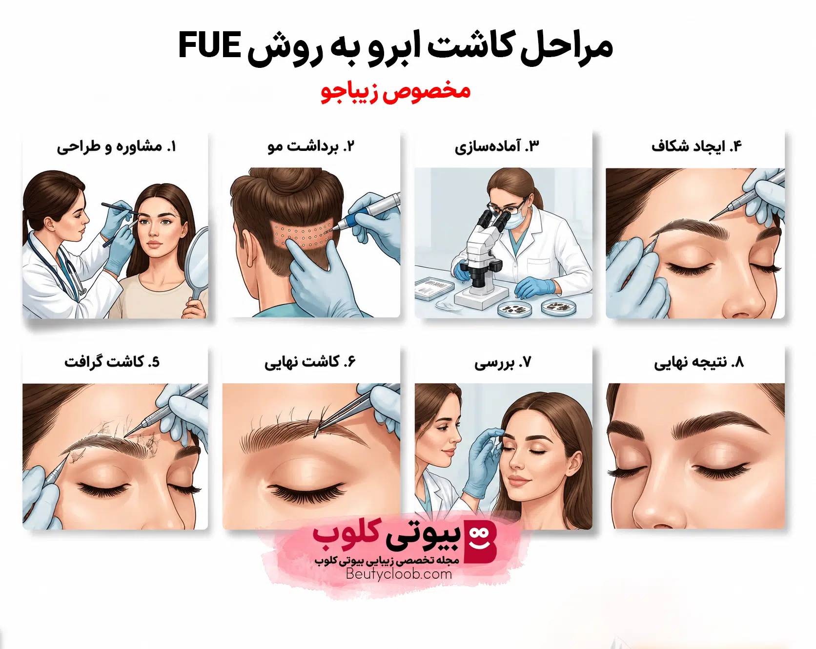 کاشت ابرو به روش (FUE)