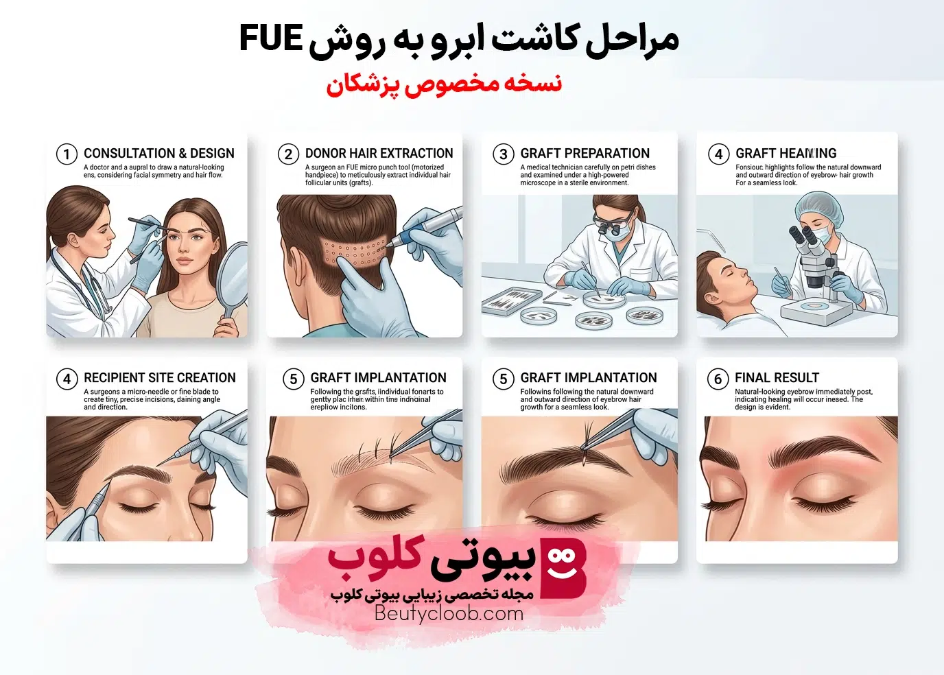 کاشت ابرو به روش (FUE)