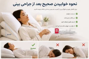 خواب بعد از رینوپلاستی