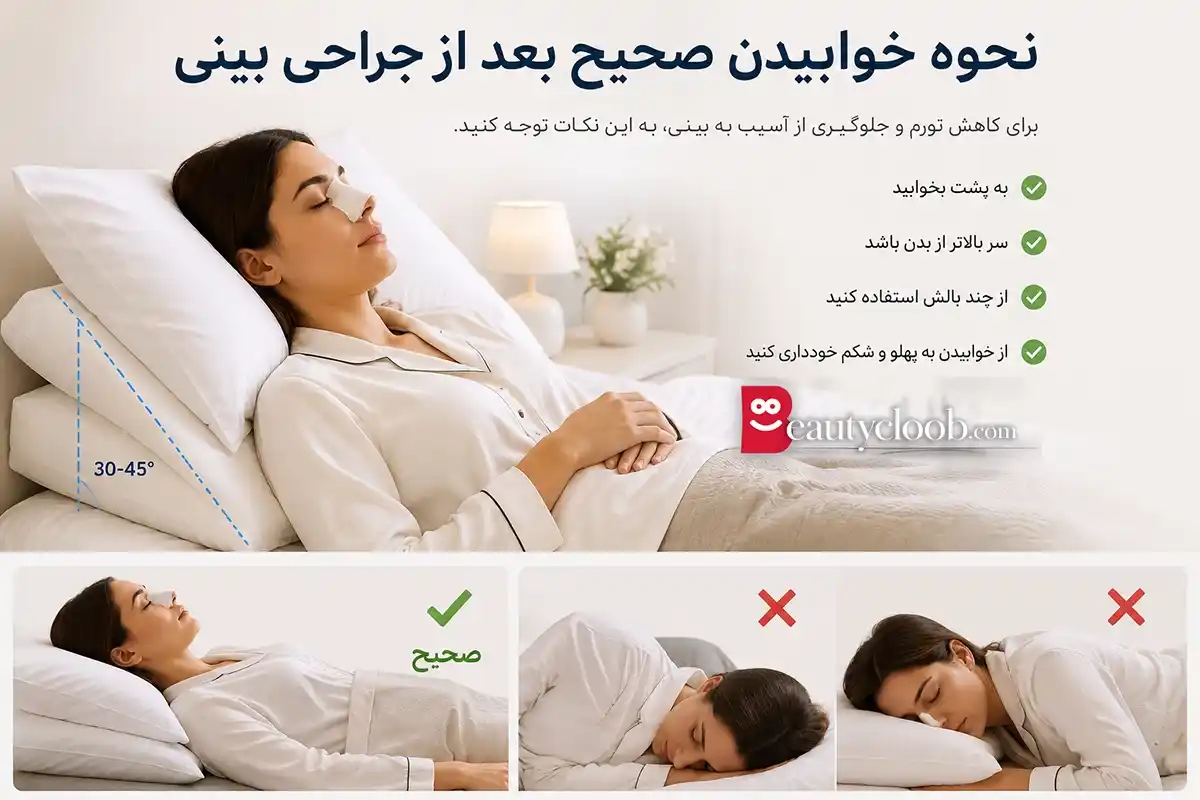 خواب بعد از رینوپلاستی