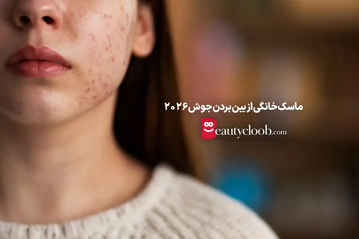ماسک طبیعی ضد جوش صورت