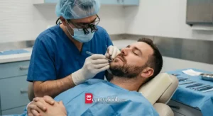 کاشت ریش و سبیل