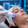تکنولوژی‌های انرژی‌بیس در زیبایی