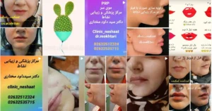 بهترین کلینیک‌های لاغری در کرج