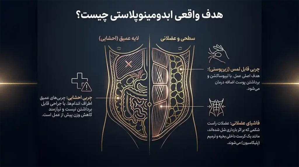 مراقبت بعد از ابدومینوپلاستی