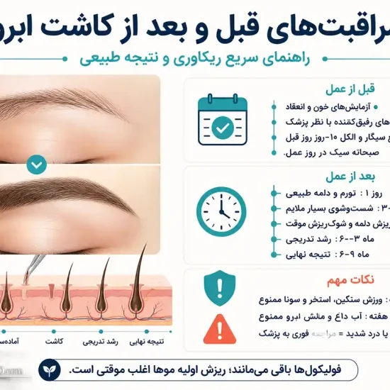 مراقبت های قبل و بعد کاشت ابرو