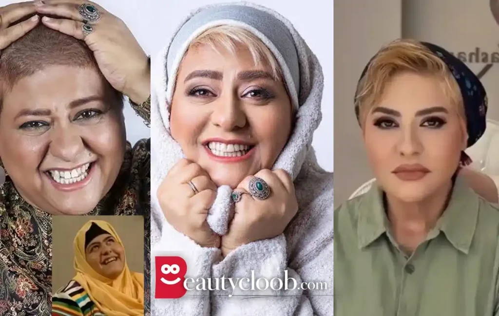 عکس قبل و بعد رابعه اسکویی