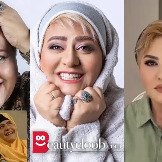 عکس قبل و بعد رابعه اسکویی